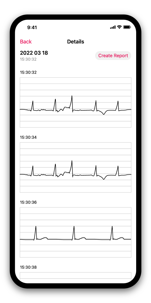 BEATINFO Health App - Irregular Heart Rate Detection
