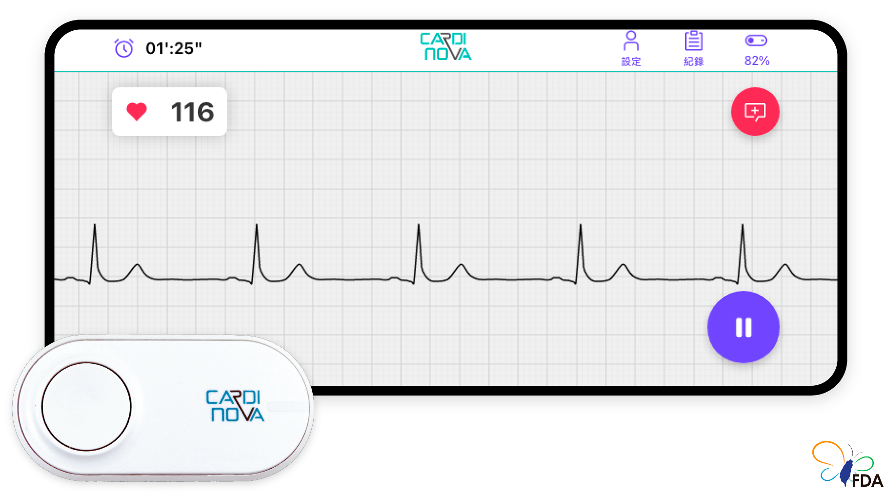 CARDINOVA ECG – ECG Sensor and Cardinova App